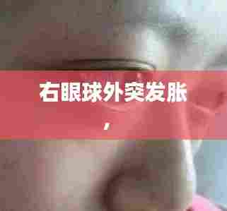 右眼球外突发胀,