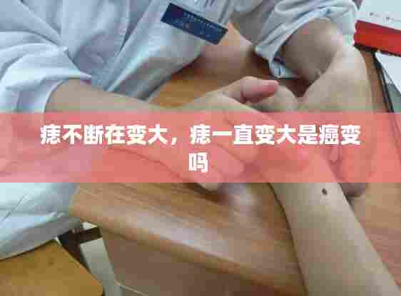 痣不断在变大,痣一直变大是癌变吗
