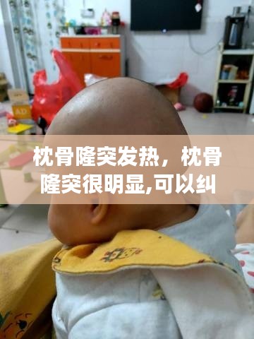 枕骨隆突发热,枕骨隆突很明显,可以纠正吗