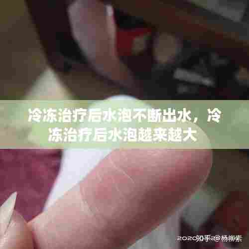冷冻治疗后水泡不断出水,冷冻治疗后水泡越来越大