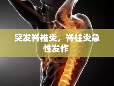 突发脊椎炎,脊柱炎急性发作