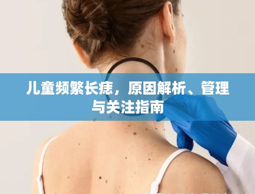 儿童频繁长痣,原因解析、管理与关注指南